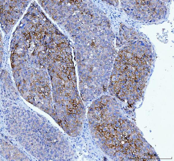 Poliovirus Receptor/PVR Mouse Monoclonal Antibody