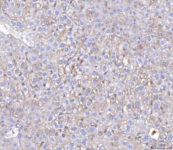 Poliovirus Receptor/PVR Mouse Monoclonal Antibody