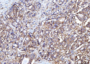 Poliovirus Receptor/PVR Mouse Monoclonal Antibody