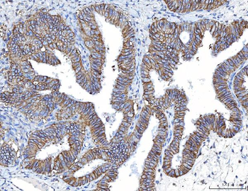 Poliovirus Receptor/PVR Mouse Monoclonal Antibody