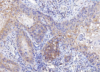 Poliovirus Receptor/PVR Mouse Monoclonal Antibody