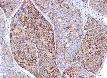 Poliovirus Receptor/PVR Mouse Monoclonal Antibody
