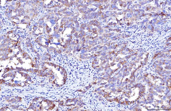 Poliovirus Receptor/PVR Mouse Monoclonal Antibody