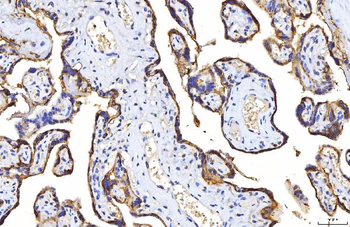 Poliovirus Receptor/PVR Mouse Monoclonal Antibody