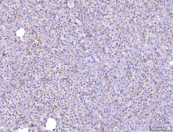 Poliovirus Receptor/PVR Mouse Monoclonal Antibody