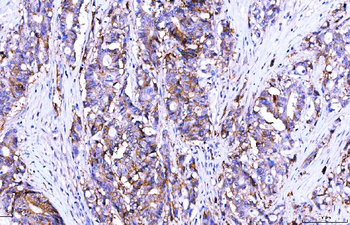 Poliovirus Receptor/PVR Mouse Monoclonal Antibody