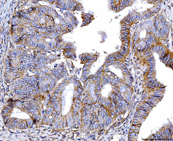 Poliovirus Receptor/PVR Mouse Monoclonal Antibody