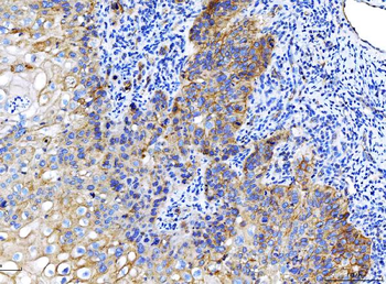Poliovirus Receptor/PVR Mouse Monoclonal Antibody