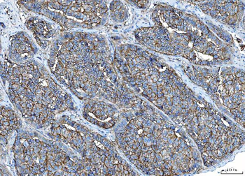 Poliovirus Receptor/PVR Mouse Monoclonal Antibody