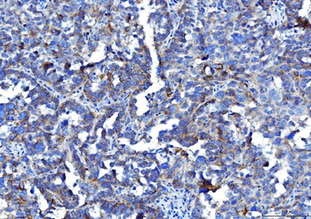 Poliovirus Receptor/PVR Mouse Monoclonal Antibody