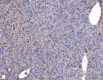 Poliovirus Receptor/PVR Mouse Monoclonal Antibody