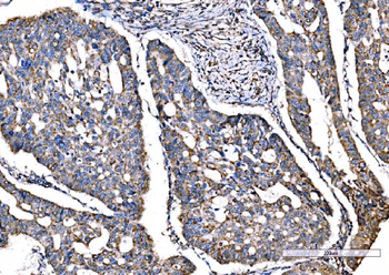 SOD2 Mouse Monoclonal Antibody