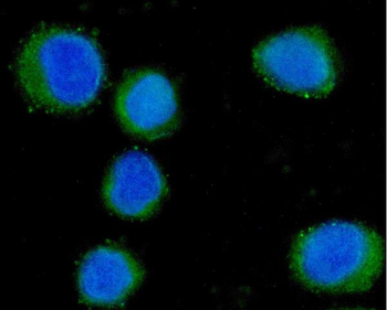 CD55 Mouse Monoclonal Antibody