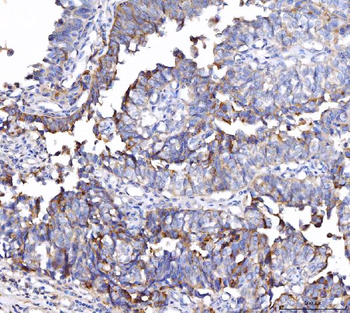 CD55 Mouse Monoclonal Antibody