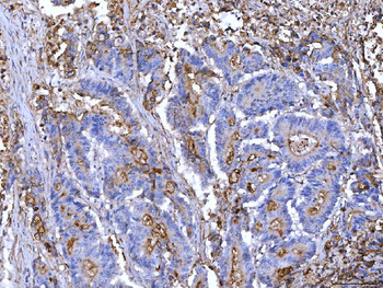 CD55 Mouse Monoclonal Antibody