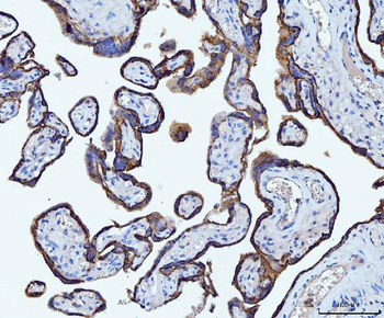 CD55 Mouse Monoclonal Antibody