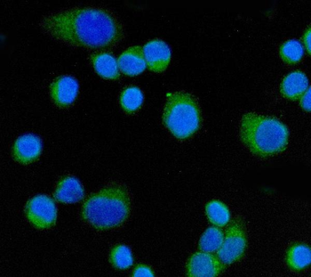 CD55 Mouse Monoclonal Antibody