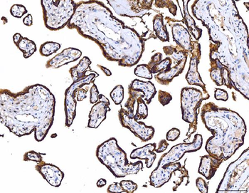 CD55 Mouse Monoclonal Antibody