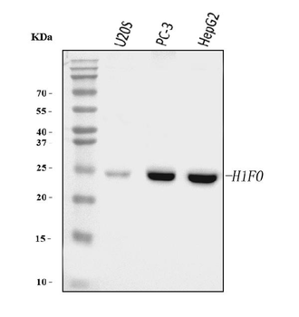 Histone H1.0/H1F0/H1 Mouse Monoclonal Antibody