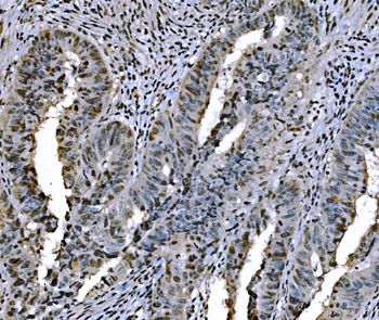 Histone H1.0/H1F0/H1 Mouse Monoclonal Antibody
