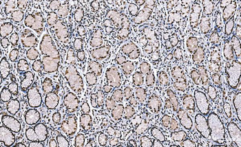 Histone H1.0/H1F0/H1 Mouse Monoclonal Antibody