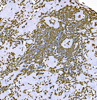 Histone H1.0/H1F0/H1 Mouse Monoclonal Antibody