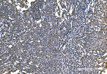 Histone H1.0/H1F0/H1 Mouse Monoclonal Antibody
