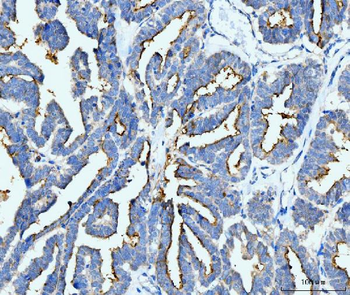 ICAM1 Mouse Monoclonal Antibody