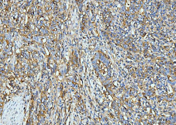 ICAM1 Mouse Monoclonal Antibody