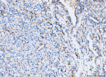 ICAM1 Mouse Monoclonal Antibody