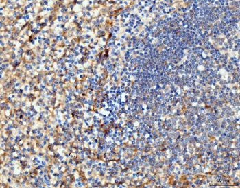 ICAM1 Mouse Monoclonal Antibody