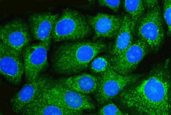 Beclin 1 Mouse Monoclonal Antibody