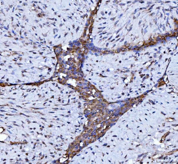 Beclin 1 Mouse Monoclonal Antibody