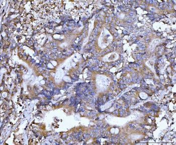 Beclin 1 Mouse Monoclonal Antibody