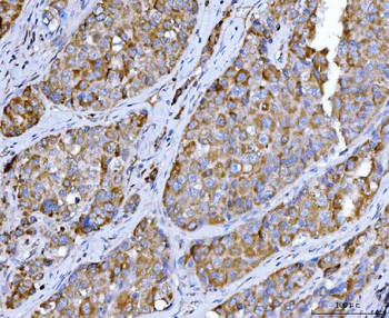 Beclin 1 Mouse Monoclonal Antibody