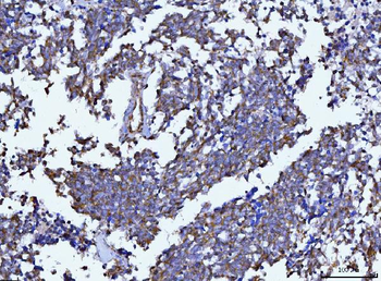 Beclin 1 Mouse Monoclonal Antibody