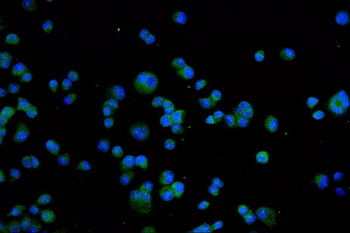 TRPV1 Rabbit Polyclonal Antibody