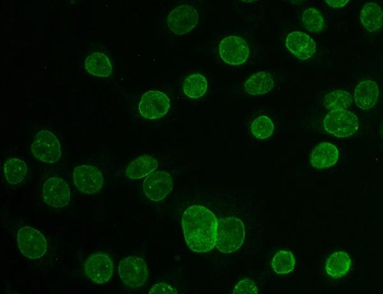 TPR Rabbit Polyclonal Antibody