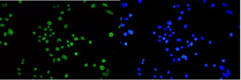 TPR Rabbit Polyclonal Antibody