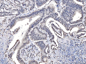 TPR Rabbit Polyclonal Antibody