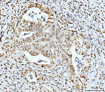 53BP1/TP53BP1 Rabbit Polyclonal Antibody