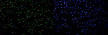 53BP1/TP53BP1 Rabbit Polyclonal Antibody
