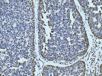 53BP1/TP53BP1 Rabbit Polyclonal Antibody