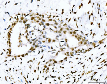 53BP1/TP53BP1 Rabbit Polyclonal Antibody