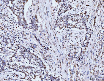 53BP1/TP53BP1 Rabbit Polyclonal Antibody