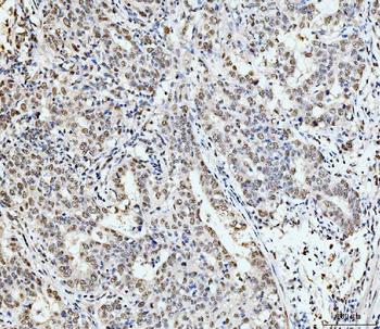 53BP1/TP53BP1 Rabbit Polyclonal Antibody