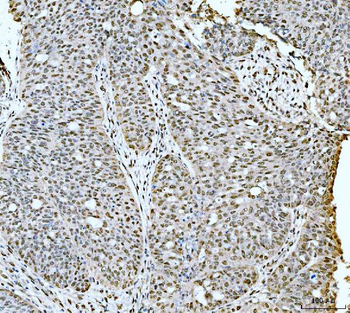 53BP1/TP53BP1 Rabbit Polyclonal Antibody