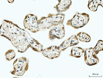 53BP1/TP53BP1 Rabbit Polyclonal Antibody