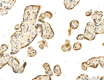 53BP1/TP53BP1 Rabbit Polyclonal Antibody