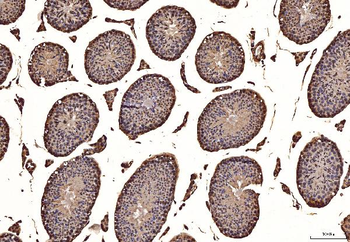NAK/TBK1 Rabbit Polyclonal Antibody